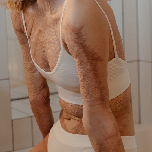 coversquare-1000-woorden